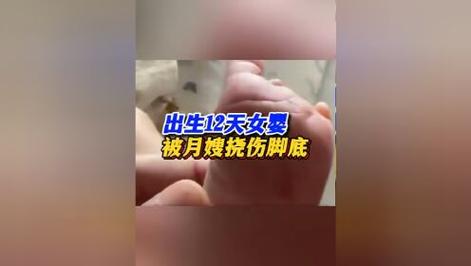 生孩子的东西在怀孕期间怎么准备女婴被月嫂挠伤脚底视频女婴被月嫂挠伤脚底