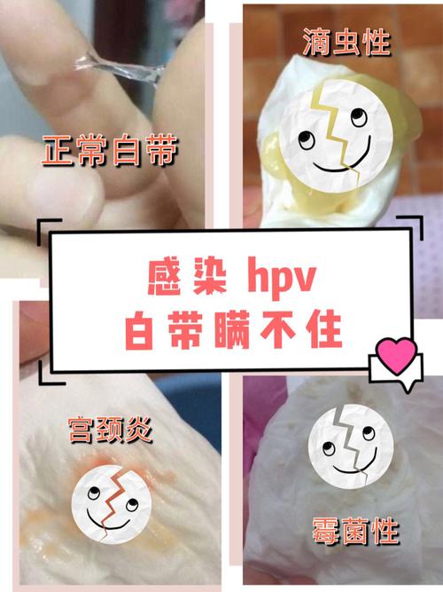 女性保险多大买合适做美甲感染hpv频繁美甲感染HPV