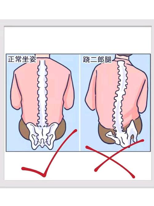 一坐下来就忍不住跷二郎腿是怎么回事长期翘二郎腿的危害有哪些长期翘二郎腿的危害 美甲